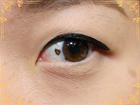 Mole In Eye Meaning Eyeball Eyelid Eyebrow Moles What Spiritual