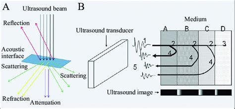 Minimizing Electrical Noise To Improve Medical Ultrasound Images Part