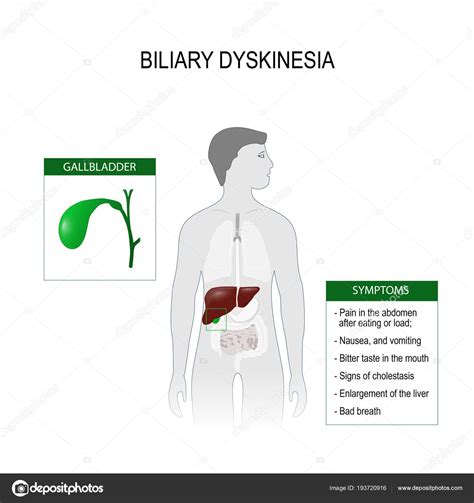 Biliary Dyskinesia Symptoms