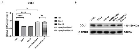 Frontiers Dramatic Effect Of Botulinum Toxin Type A On Hypertrophic