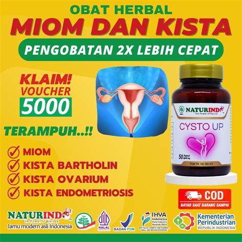 Jual Obat Miom Dan Kista Batholin Kista Ovarium Kista Ganglion Kista