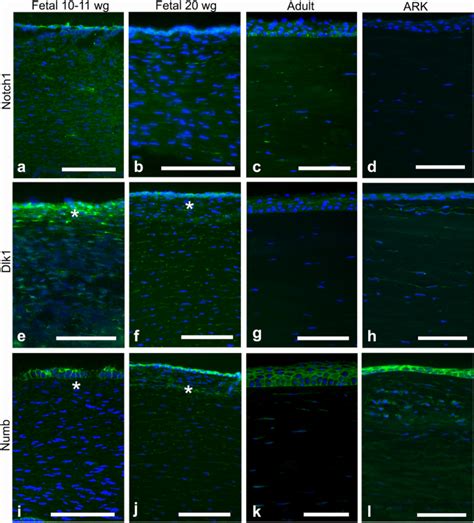 人胎儿角膜中无虹膜相关角膜病变相关细胞信号通路 Histochemistry and Cell Biology X MOL