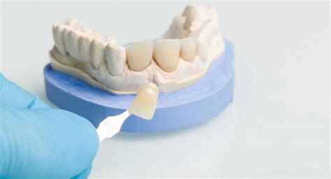 Zirconium Veneers In Turkey Medicasmile