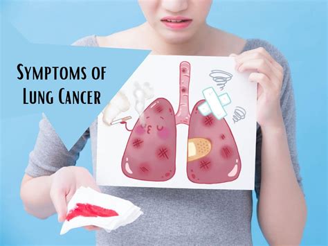 10 Surprising Symptoms Of Lung Cancer You Should Never Ignore