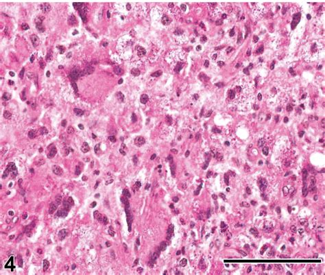 Characterization Of Uterine Granular Cell Tumors In B6c3f1 Mice A Histomorphologic