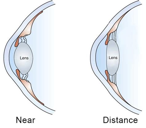 Eye Doctor Burlington Presbyopia Burlington New England Vision