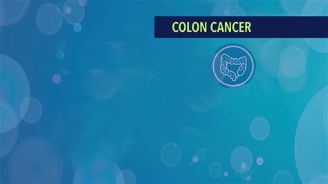 Treatment of Stage IV- Metastatic or Recurrent Colon Cancer - CancerConnect