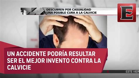 La Cebolla Para El Cabello Mito O Realidad Moda Retro