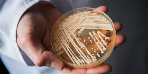 Deadly Fungi Are Infecting More Americans - WSJ