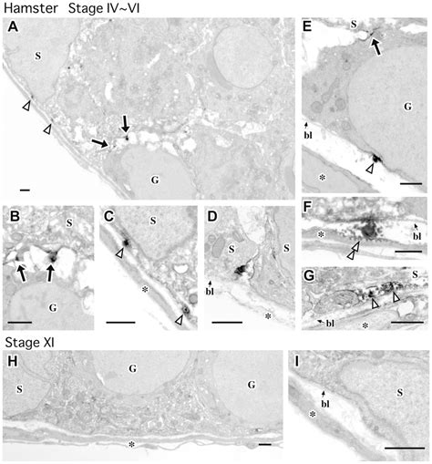 Immunoelectron Microscopic Analysis Showing GDNF Positive Signals Along