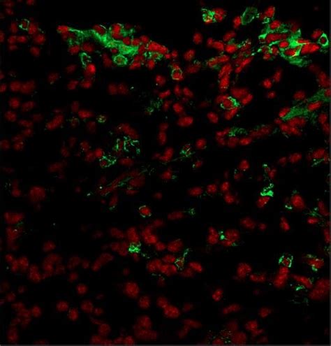 New molecular mechanism that regulates the sentinel cells of the immune ...