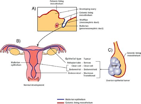 Histogenesis Of Ovarian Epithelial Tumors Download Scientific Diagram