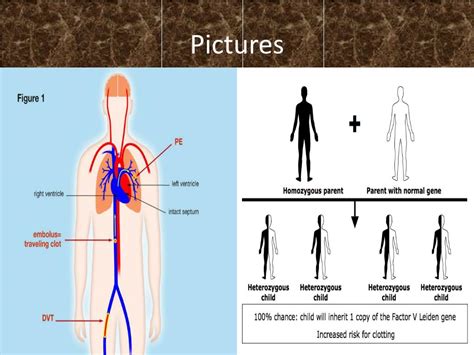 Ppt Factor V Leiden Thrombophilia Powerpoint Presentation Free