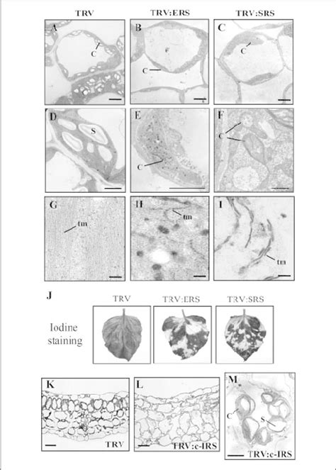 Ultrastructural Analysis Of Mesophyll Cell Chloroplasts And Download Scientific Diagram