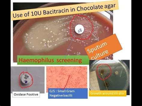 Chocolate agar: basis, uses and preparation - science - 2024