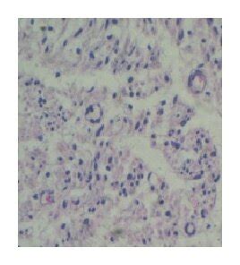 ((a), (b), and (c)) HE staining of transverse nerve slices from each... | Download Scientific ...