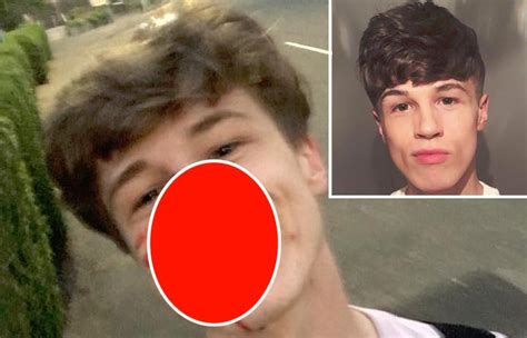 Ragazzo Picchiato Gay Sorriso Scozia