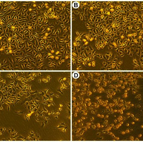 Morphological Characteristics Of SGC 7901 Cells After Treated With