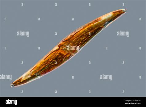 Phylum Chrysophyta Diatoms