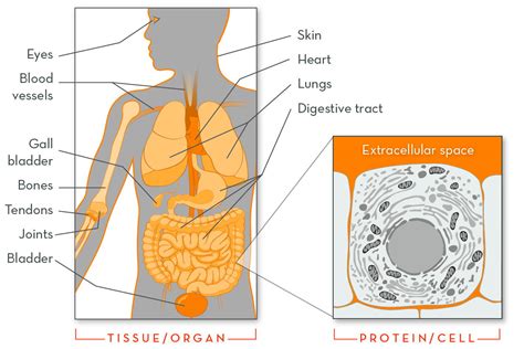 Marfan Syndrome