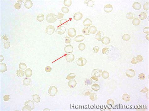 HematologyOutlines - Atlas