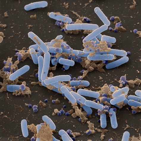 bacillus pumilus sem photograph  oliver meckes eye  science pixels