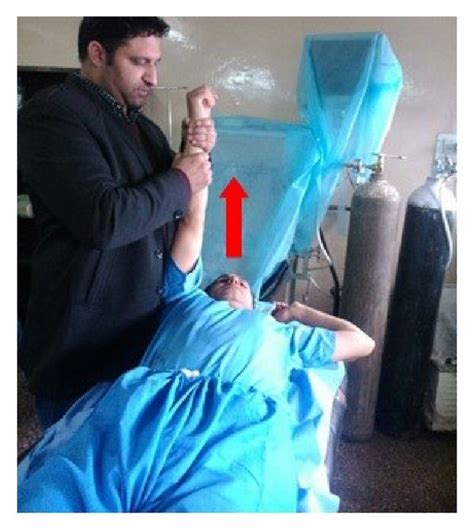 Method of shoulder reduction. Figure showing the method of shoulder ...