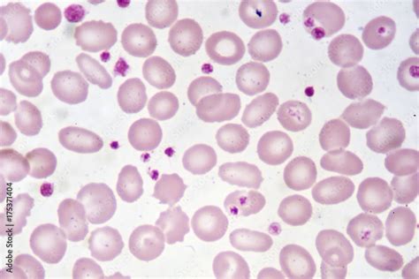 Red Blood Cells And Platelet In Blood Smear Stock Photo Adobe Stock