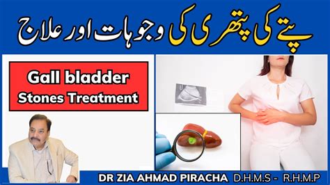 Gall Bladder Stone Symptoms Treatment Gallstones Causes Pitte Ki