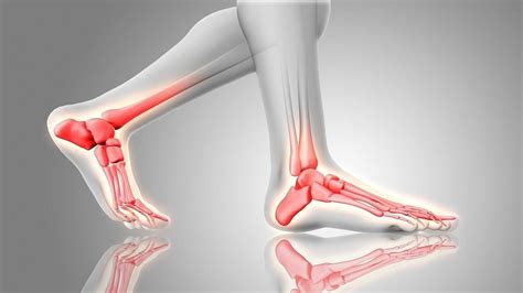 Drop foot: Causes, symptoms and treatment for a speedy recovery