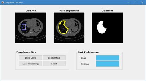 Metode Segmentasi Citra Digital Pemrograman Matlab