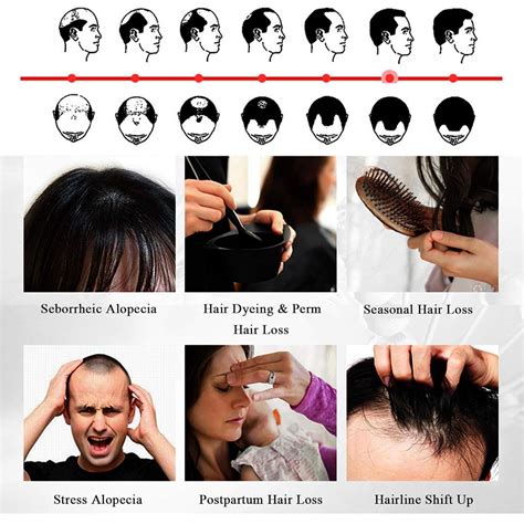 hair growth accelerator 7