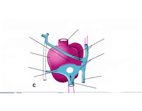 Sinus Venosus Quiz