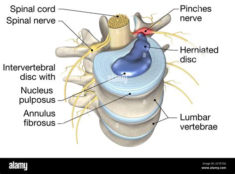 D Illustration Showing Lumbar Vertebra With Intervertebral Disc