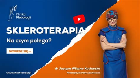 Skleroterapia Na Czym Polega YouTube