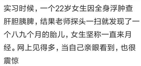 你遇見過什麼人在打胎？ 每日頭條