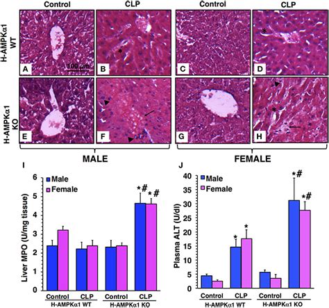 Frontiers Hepatocyte Specific Deletion Of Ampkα1 Results In Worse Outcomes In Mice Subjected