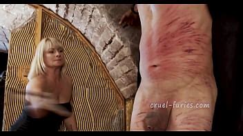 Painful Red Bruises On Poor Guy S Flesh XVIDEOS