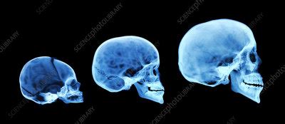 Human skull development - Stock Image - P120/0208 - Science Photo Library