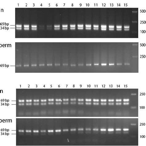 Differences Between Fin And Sperm Dna Amplified With Sexspecific