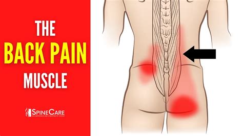 The Lower Back Pain Muscle How To Release It For Instant Relief Youtube