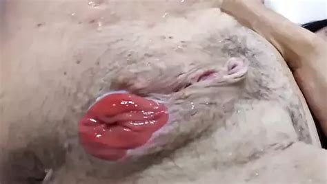 Lizzy Yum Spekulum Mit Dildo Und Muschidehnung Nach Der Op Xhamster