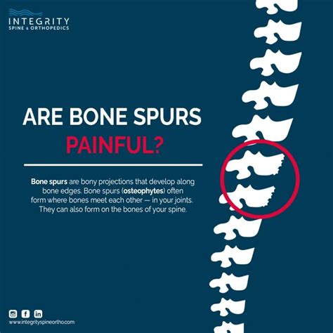 Are Bone Spurs Painful? | Integrity Spine & Orthopedics