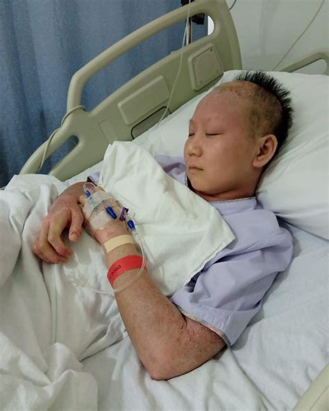 Meet Jing Rui The Singaporean With Severe Eczema Running A Skincare