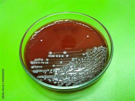 Hemolysis Bacterial Colonies To Induce Hemolysis When Grown On Blood