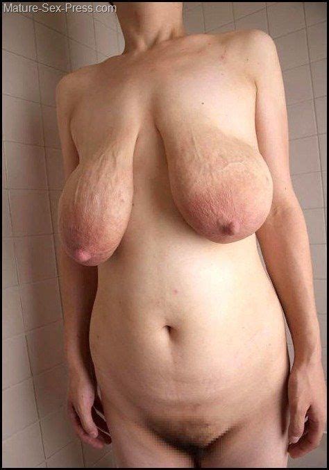 Floppy Mature Tit Stretch Marks Sex Pictures Pass