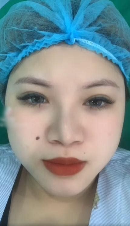 Hết hút lít mỡ hot girl ngực khủng lại dao kéo mặt tiền Xây Dựng