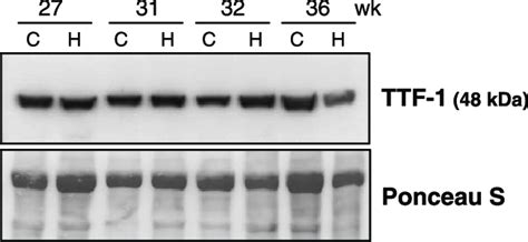 TTF1 Protein In Human Fetal Lungs Western Blot Was Performed In Lung