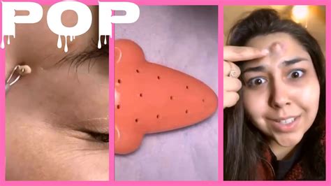 Amazing Popping Huge Blackheads And BEST Pimple Popping TIKTOK Videos