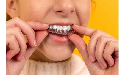 Impronta Dentale Digitale I Vantaggi In Odontoiatria Prima La Martesana